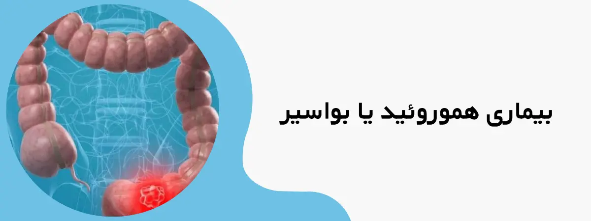 مریضی هموروئید یا بواسیر