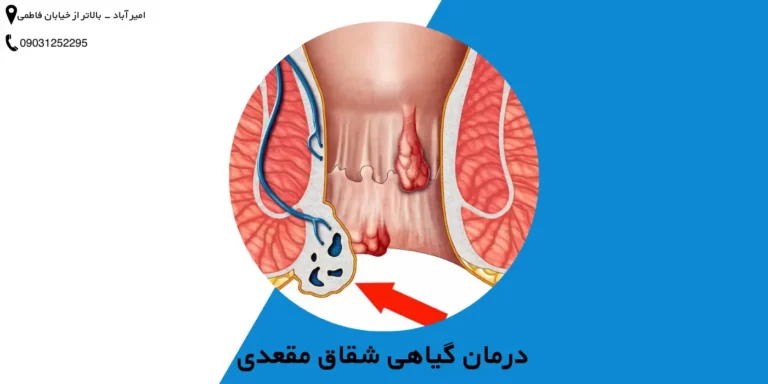 درمان گیاهی شقاق مقعدی (درمان گیاهی زخم مقعدی)