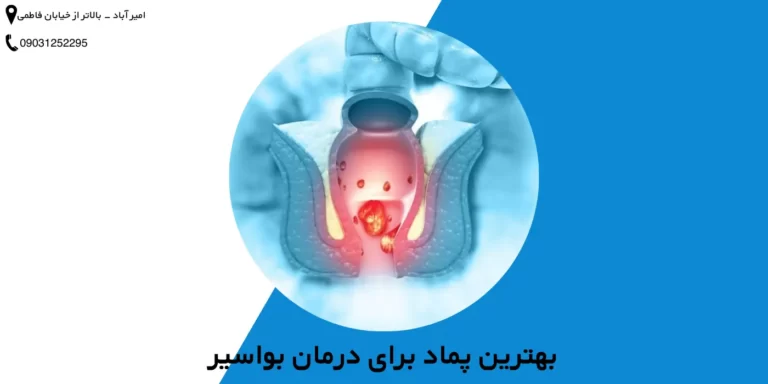 بهترین پماد برای درمان بواسیر
