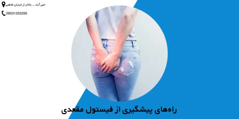 راه‌های پیشگیری از فیستول مقعدی