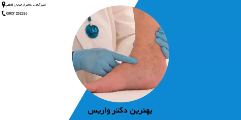 بهترین دکتر واریس پا در تهران