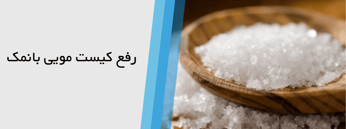 درمان کیست مویی با نمک