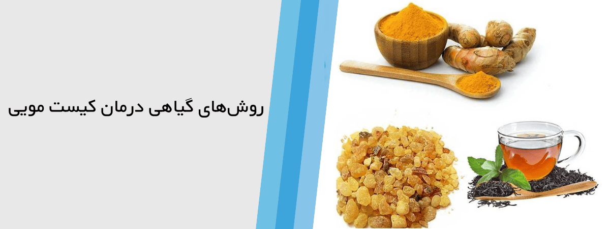 درمان گیاهی کیست مویی(سینوس پیلونیدال) با روش سنتی