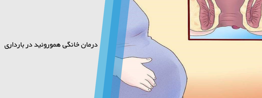 درمان خانگی برای هموروئيد در زمان حاملگی