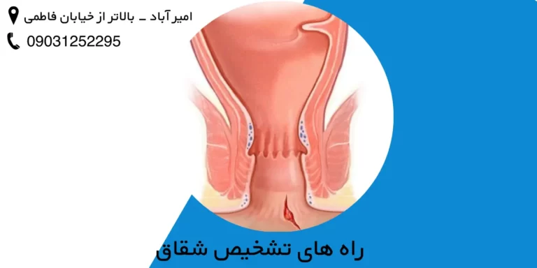راه های تشخیص شقاق (نحوه معاینه شقاق)