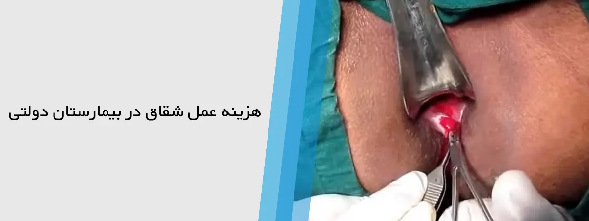هزینه جراحی شقاق مقعدی در بیمارستان های دولتی