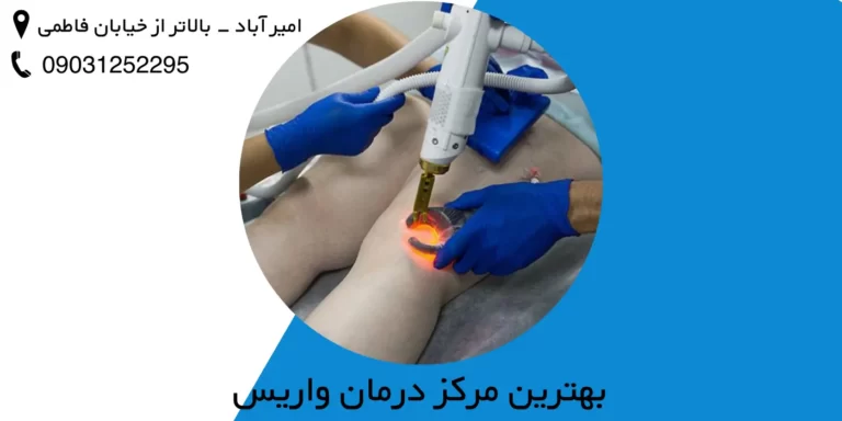 مرکز درمان واریس در تهران