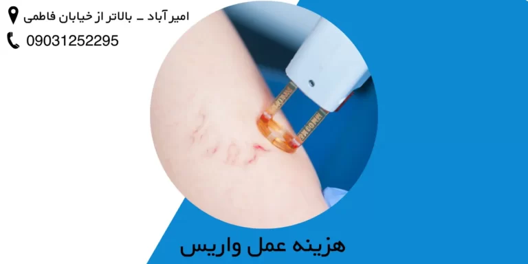 هزینه عمل جراحی واریس پا