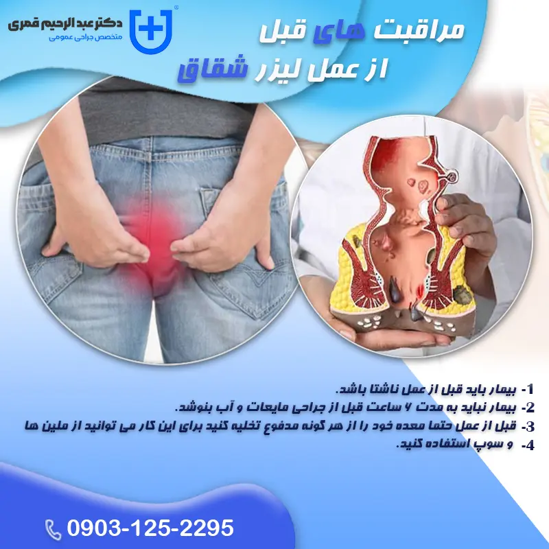 مراقبتهای بعد از عمل لیزر شقاق