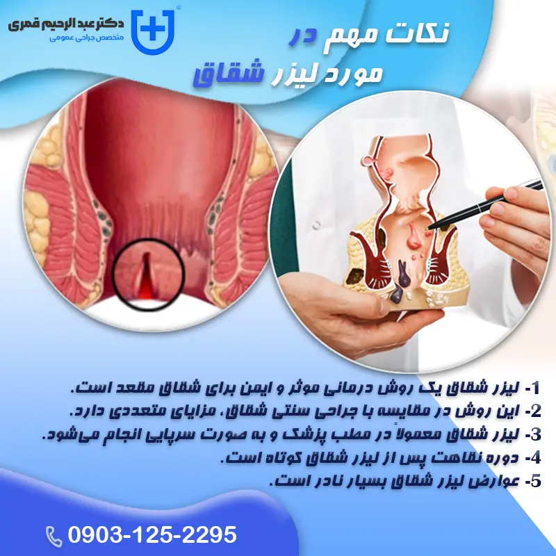 نکات مهم در مورد لیزر شقاق که باید بدانید