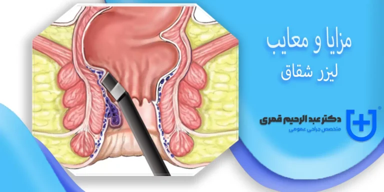 مزایا و معایب لیزر شقاق + عوارض لیزر شقاق مقعدی