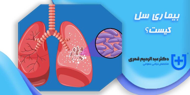 بیماری سل