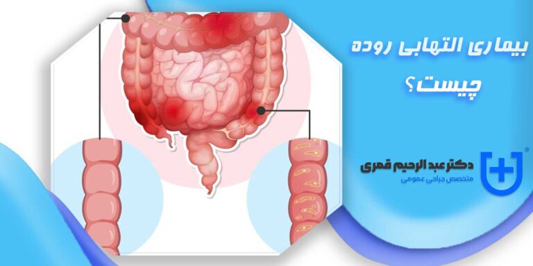 بیماری التهابی روده + علائم و دلایل آن