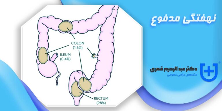 نهفتگی مدفوع چیست؟