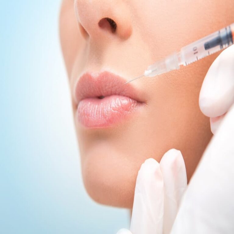 چرا ژوویدرم ایکس‌ سی برای درمان چین و چروک‌های بین بینی و دهان بسیار مؤثر است؟