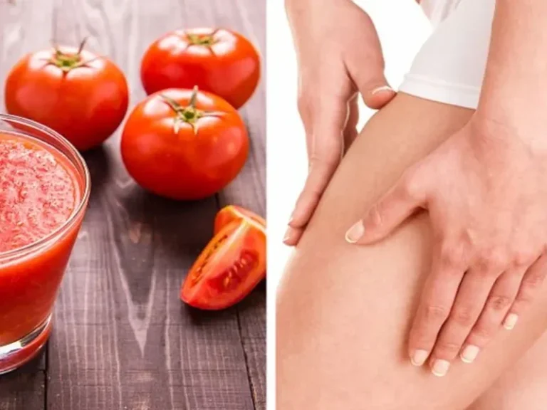 واریس و رژیم غذایی: نکاتی برای بهبود سلامت رگ‌ها