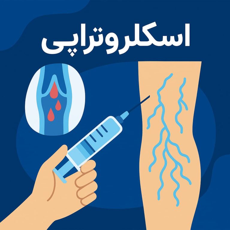 آیا اسکلروتراپی کم دردتر از لیزر درمانی است؟