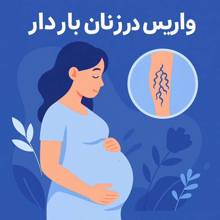 واریس در زنان باردار و راه های درمان آن