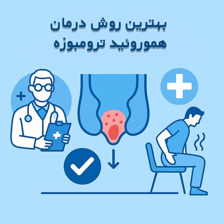 بهترین روش درمان هموروئید ترومبوزه چیست؟ | درد کمتر، بهبودی سریع‌تر