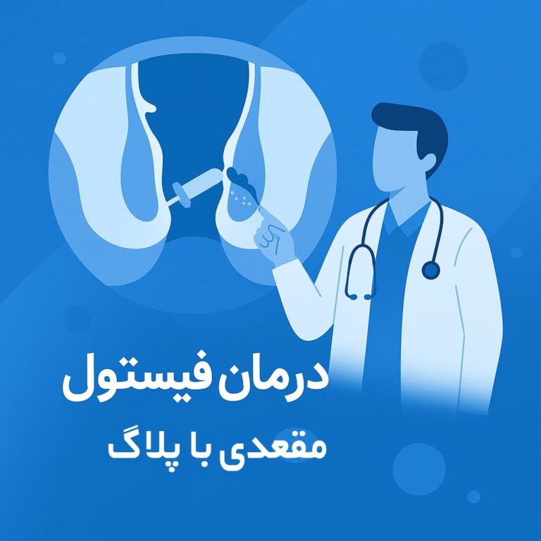 درمان فیستول مقعدی با استفاده از پلاگ؛ راهکاری نوین و کم‌تهاجمی