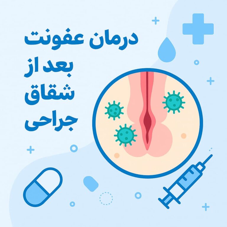 درمان عفونت بعد از جراحی شقاق
