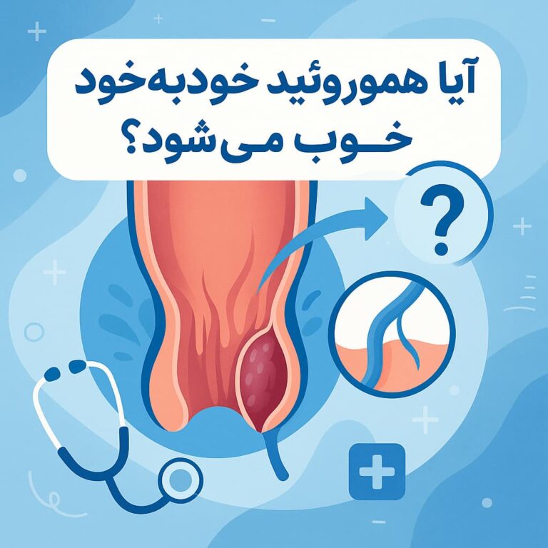آیا هموروئید خودبه‌خود خوب می‌شود؟ حقیقت علمی پشت بهبودی خودکار