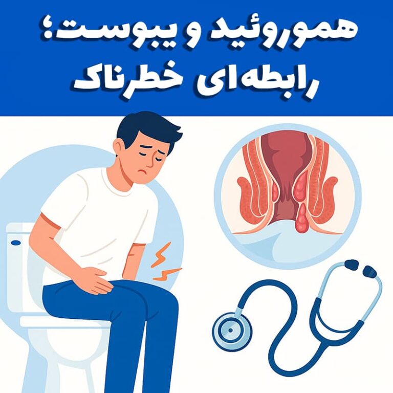 هموروئید و یبوست؛ رابطه‌ای خطرناک که نباید نادیده بگیرید