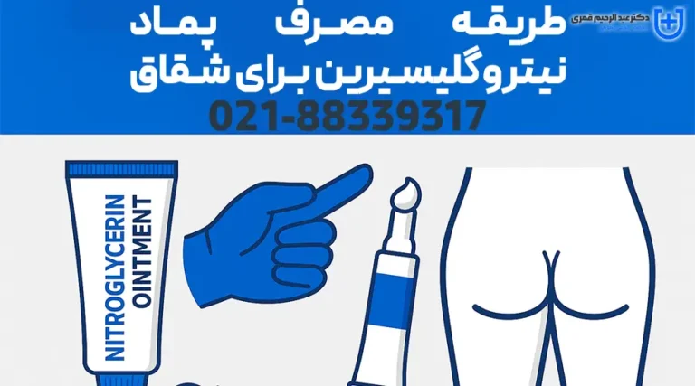 طریقه مصرف پماد نیتروگلیسیرین برای شقاق
