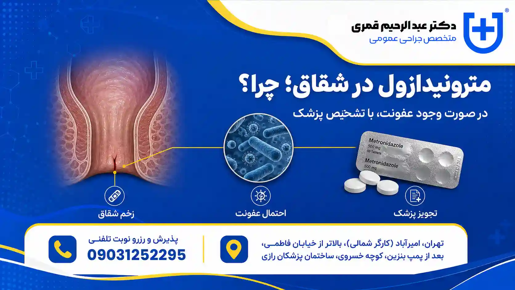 چرا مترونیدازول برای درمان شقاق توصیه می‌شود؟