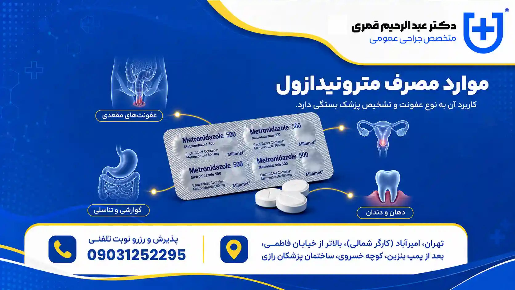 موارد مصرف قرص مترونیدازول